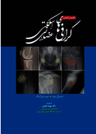 تفسیر آسان گرافی های اسکلتی عضلانی 2021