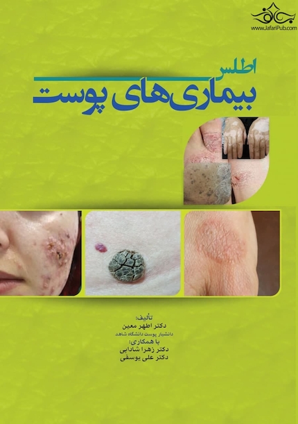 اطلس بیماری های پوست