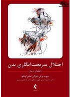 اختلال بدریخت انگاری بدن