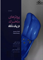 پروتزهای متحرک در یک نگاه 2020