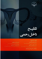 تلقیح داخل رحمی