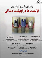 راهنمای بالینی و لابراتواری اباتمنت ها در ایمپلنت دندانی