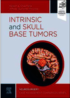 Intrinsic and Skull Base Tumors: Neurosurgery: Case Management Comparison Series2020