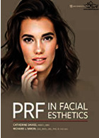 PRF in Facial Esthetics | در زیبایی صورت PRF
