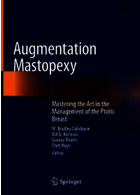Augmentation Mastopexy: Mastering the Art in the Management of the Ptotic | Breast2020تقویت Mastopexy: تسلط بر هنر در مدیریت پستان پتوتیک