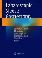 Laparoscopic Sleeve Gastrectomy2021آستین کامل معده