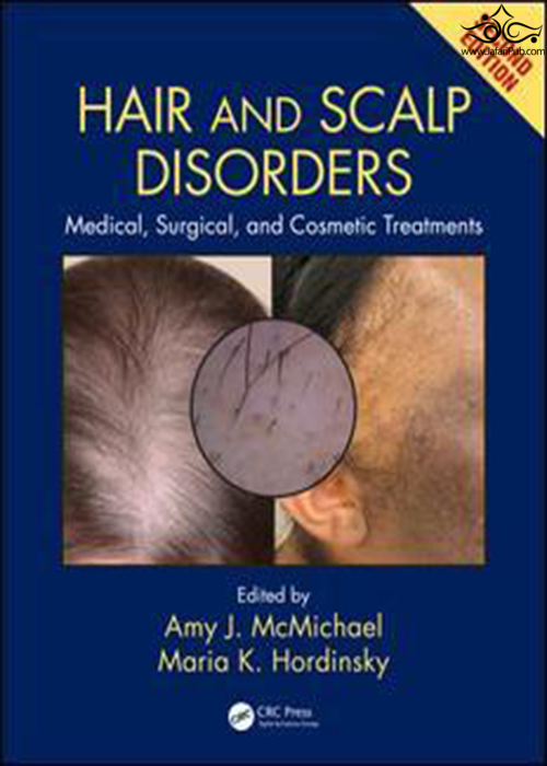 Hair and Scalp Disorders: Medical, Surgical, and Cosmetic Treatments, Second Edition2018 ELSEVIER