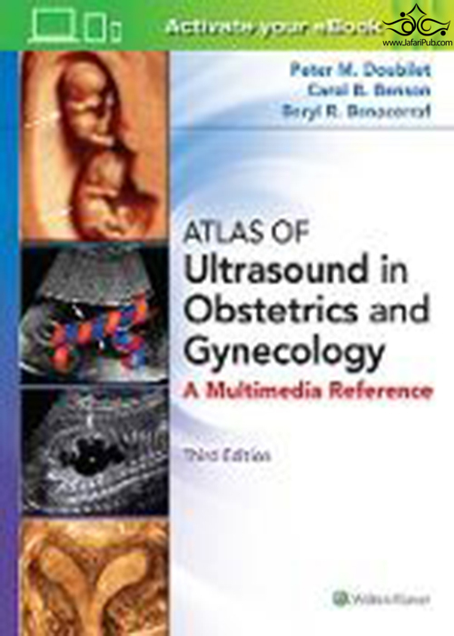 Atlas of Ultrasound in Obstetrics and Gynecology Atlas of Ultrasound in Obstetrics and Gynecology 2018 ELSEVIER