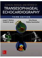 راهنمای بالینی و بررسی اکوکاردیوگرافی انتقال دهنده Clinical Manual and Review of Transesophageal Echocardiography