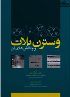 وسترن بلات و چالش های آن