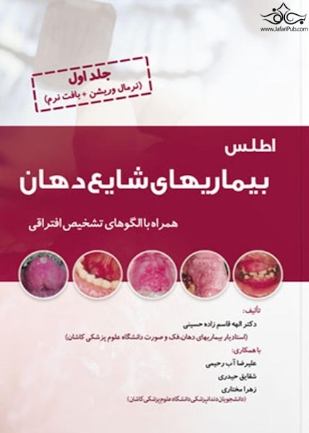 اطلس بیماری های شایع دهان جلد اول (نرمال وریشن + بافت نرم)