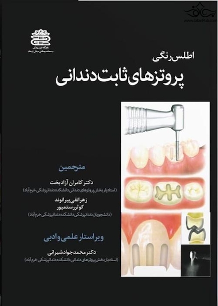 اطلس پروتزهای ثابت دندانی جلد 1