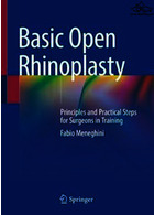 Basic Open Rhinoplasty : Principles and Practical Steps for Surgeons in Training | جراحی زیبایی بینی باز اولیه: اصول و مراحل عملی جراحان در آموزش