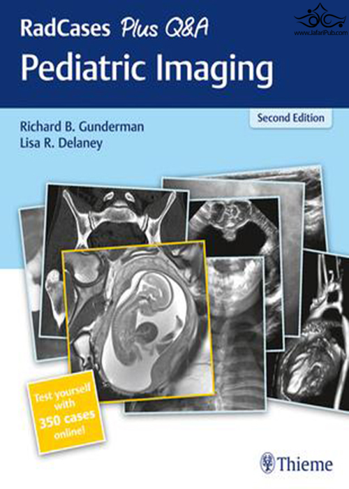 RadCases Plus Q&A Pediatric Imaging2019تصویربرداری پرسش و پاسخ کودکان Thieme