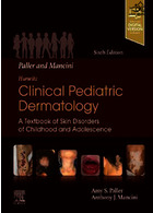 2021 Paller and Mancini - Hurwitz Clinical Pediatric Dermatology: A Textbook of Skin Disorders of Childhood & Adolescence