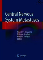Central Nervous System Metastases متاستازهای سیستم عصبی مرکزی