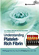 Understanding Platelet-Rich Fibrin2021 | آشنایی با فیبرین غنی از پلاکت