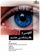 آناتومی و بافت شناسی چشم