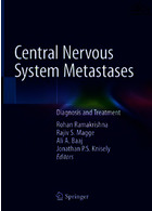 Central Nervous System Metastases: Diagnosis and Treatment2020متاستازهای سیستم عصبی مرکزی: تشخیص و درمان