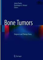 Bone Tumors: Diagnosis and Therapy Today 2021 | تومورهای استخوانی