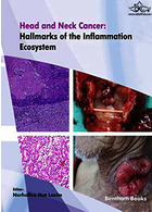 Head and Neck Cancer: Hallmarks of The Inflammation Ecosystem-Volume 2  2021 سرطان سر و گردن: نشانه های اکوسیستم التهاب-جلد 2