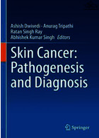Skin Cancer: Pathogenesis and Diagnosis2021سرطان پوست
