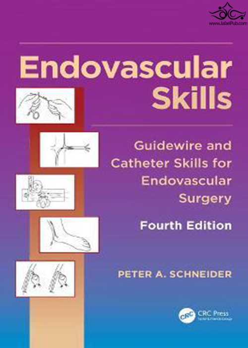 Endovascular Skills: Guidewire and Catheter Skills for Endovascular Surgery, Fourth Editionمهارتهای اندواسکولار: مهارتهای راهنمای سیم و کاتتر برای جراحی اندواسکولار ، چاپ چهارم Apple Academic Press Inc