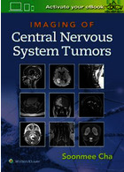 Imaging of Central Nervous System Tumors2021تصویربرداری از تومورهای سیستم عصبی مرکزی