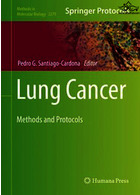 Lung Cancer: Methods and Protocols (Methods in Molecular Biology, 2279)