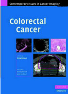 Colorectal Cancer2008سرطان روده بزرگ