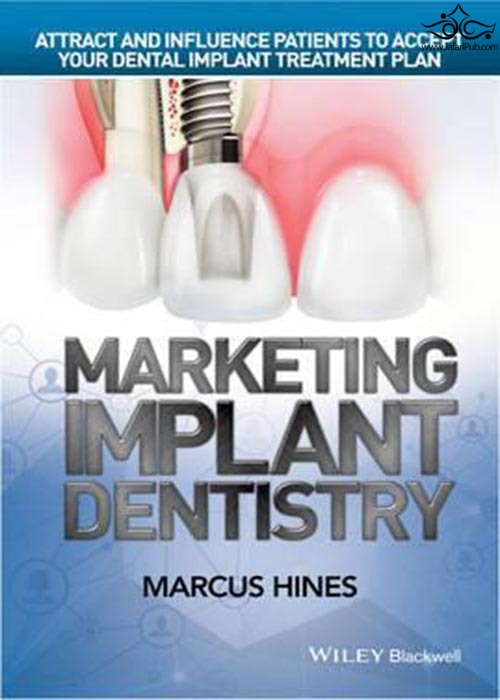 Marketing Implant Dentistry : Attract and Influence Patients to Accept Your Dental Implant Treatment Plan  John Wiley and Sons Ltd 
