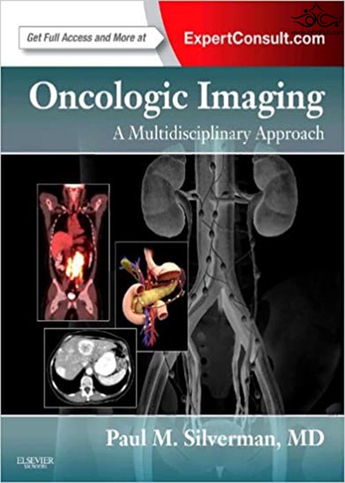 Oncologic Imaging: A Multidisciplinary Approach: Expert Consult - Online and Print ELSEVIER