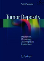 Tumor Deposits: Mechanism, Morphology and Prognostic Implications2018