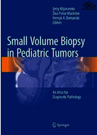 Small Volume Biopsy in Pediatric Tumorsبیوپسی حجم کوچک در تومورهای کودکان