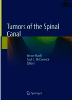 Tumors of the Spinal Canal2021تومورهای کانال نخاعی