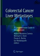 Colorectal Cancer Liver Metastases : A Comprehensive Guide to Management2020