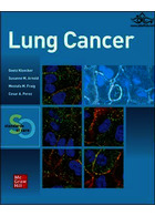 Lung Cancer: Standards of Careسرطان ریه: استانداردهای مراقبت