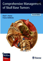 Comprehensive Management of Skull Base Tumors, Second Edition2021