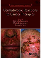 Dermatologic Reactions to Cancer Therapies2019واکنشهای پوستی به درمانهای سرطان | واکنشهای پوستی به درمانهای سرطان