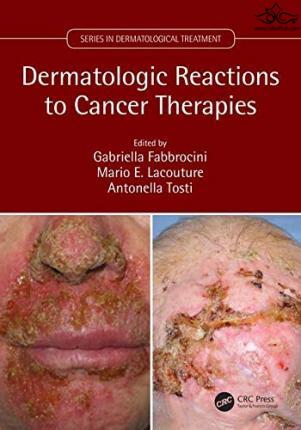 Dermatologic Reactions to Cancer Therapies2019واکنشهای پوستی به درمانهای سرطان Taylor & Francis Ltd