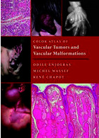 Color Atlas of Vascular Tumors and Vascular Malformations 1st Edicion 2007 | اطلس رنگی تومورهای عروقی و ناهنجاری های عروقی ویرایش اول