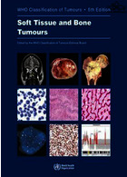 WHO classification of tumours of soft tissue and bone tumours 2020 | طبقه بندی تومورهای بافت نرم و استخوان توسط