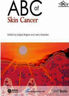ABC of Skin Cancer سرطان پوست