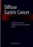 Diffuse Gastric Cancer2018سرطان معده
