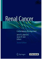 Renal Cancer : Contemporary Managementسرطان کلیه