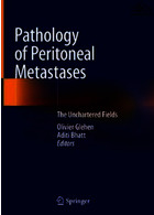 Pathology of Peritoneal Metastases : The Unchartered Fields2020آسیب شناسی متاستازهای صفاقی: زمینه های ناشناخته