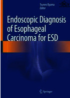 Endoscopic Diagnosis of Esophageal Carcinoma for ESD