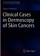 Clinical Cases in Dermoscopy of Skin Cancersموارد بالینی درموسکوپی سرطانهای پوست