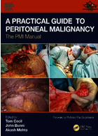 A Practical Guide to Peritoneal Malignancy : The PMI Manual