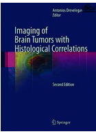 Imaging of Brain Tumors with Histological Correlations2011
